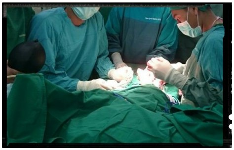 UGD Moeis NOTO 20150712_191247_1.jpg image